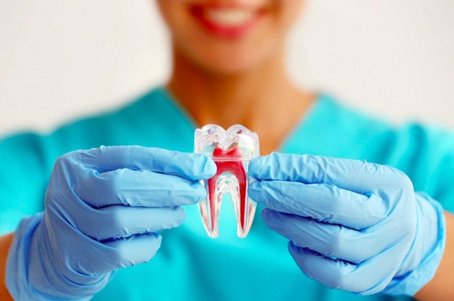 Modelo de dente com a raiz e os canais, endodontia em Braga