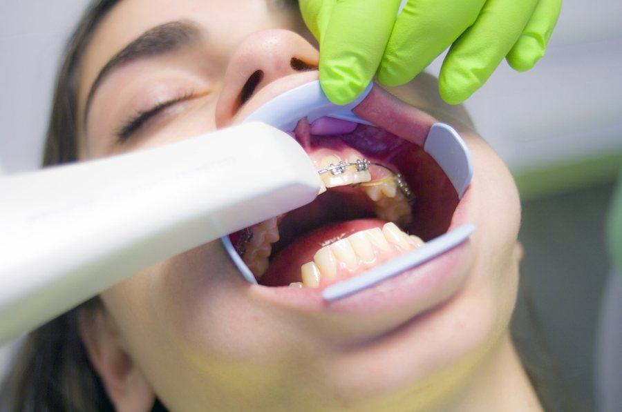 Paciente com aparelho dentário fixo em consulta de ortodontia em Braga