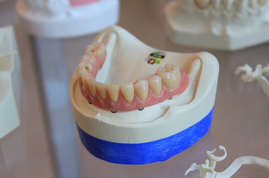 Prótese dentária removível em modelo de gesso, próteses dentárias em Braga